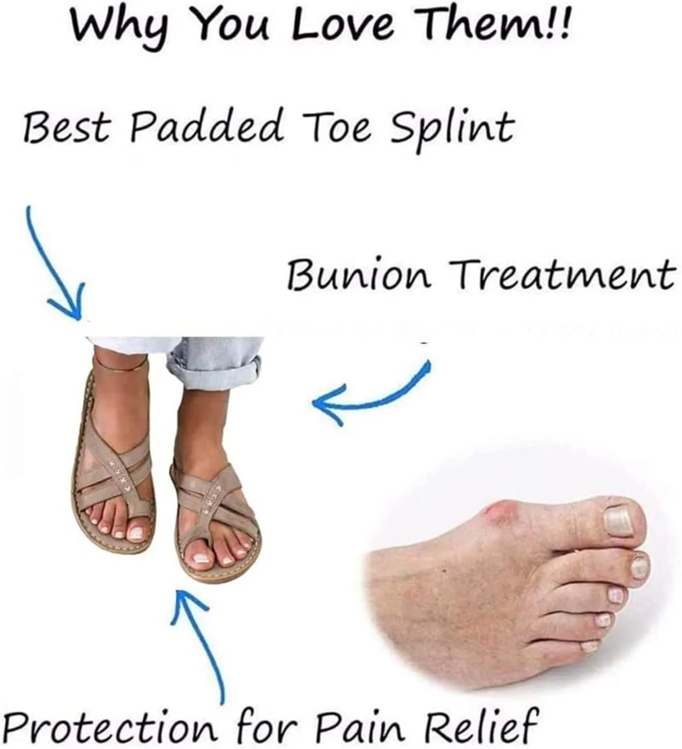 BBPM Sandals for Women Summer Bunion Correction Sandals Flip Flops Arch Support Sandals Comfy Slippers Big Toe Bone Flat Orthopedic Walking Shoes,Brass,EU37/US6